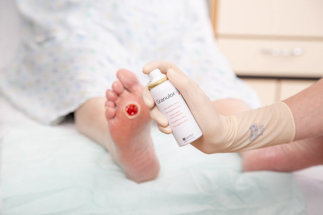 Diabetic foot patient